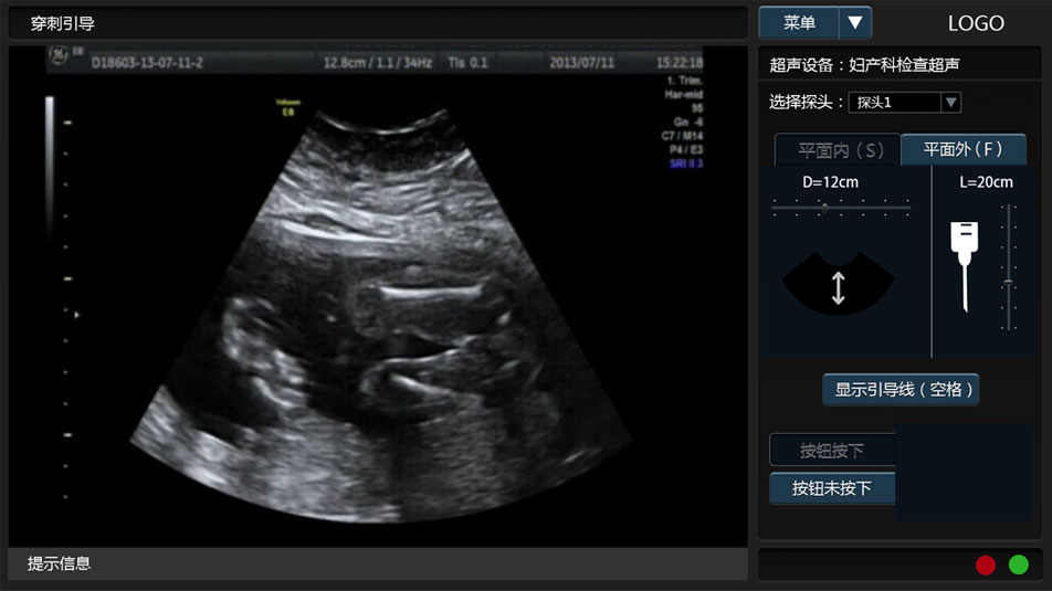 武漢睿影醫療科技超聲系統軟件界面設計